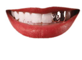 Gif animé bouche dents de fer